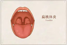 孩子扁桃体反复发炎，要不要切除？怎么护理？这样做可自救图片