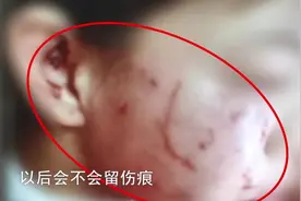 女子思维清奇，和小姑子互殴，被丈夫暴打无数次坚称：还想过下去图片