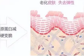 重组人源III 型胶原蛋白作用原理图片