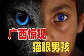 广西男孩天生夜视眼，夜晚看东西不用点灯，难道是猫妖转世？图片