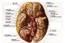 「最全总结」不同脑部位出血表现，值得收藏图片