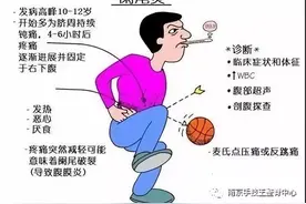 “阑尾炎”是如何形成的？图片