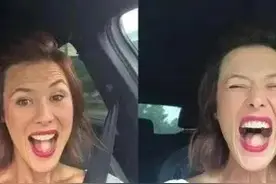 美国一小姐姐因癌症少了半个舌头，用大腿肉补上后竟长出了腿毛图片