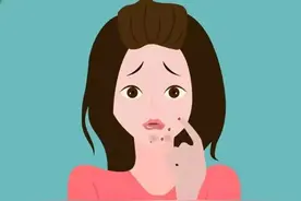 痤疮疤痕疙瘩应该怎么去除？痤疮疤痕疙瘩怎么根治？图片