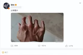41岁谢霆锋晒手部特写，手指黑瘦布满伤痕，关节红肿变形青筋明显图片
