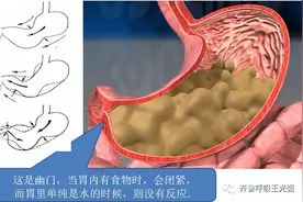 胃食管反流病-2：治疗宝典：“SLOW”策略图片