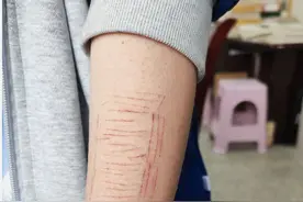 班主任丨为什么中学生自残行为越来越常见？图片