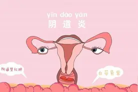 阴道分泌物不同，可能是感染了这几种病图片