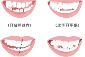 父母牙齿不好会遗传吗？真相来了！图片