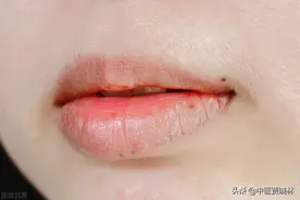 口干，口苦，口臭？两味中药，化水湿清胃热，让你口气清新每一天图片
