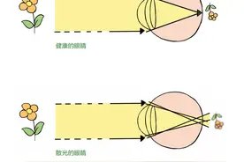 除了近视，你可能还需要了解散光和斜视！图片
