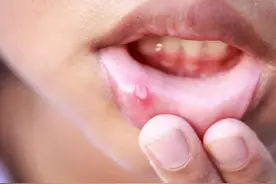 小苏打有哪些小妙招，一起来看看图片