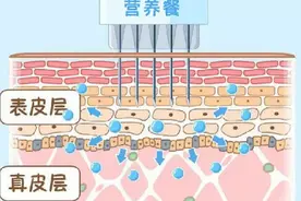 一次水光针，成本价要多少？医院赚多少？行内人说行情图片