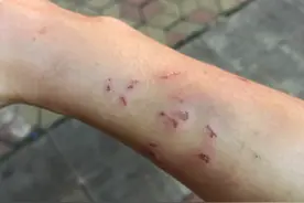 小伙遭女友抓咬身体多处受伤，律师：不算家暴，但殴打他人违法图片