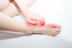 4种常见的脚气，你属于哪一种？如何正确使用脚气药膏？图片