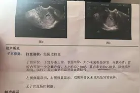 孕早期B 超检查提示“无胎心”是怎么回事？图片