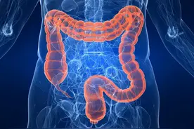 哈佛20多万人研究：降低直肠癌风险，这4类食物要少吃图片