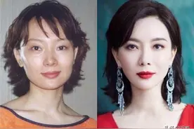 盘点9位整容女星，有人“换头改命”成一线，有人适得其反断前途图片