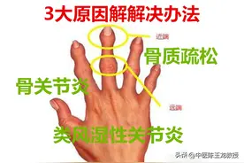 晨起手发胀、僵硬、握不拢、咔咔响？三种原因多见，解决办法如下图片