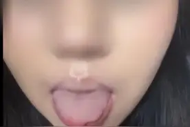 吃个菠萝，女子舌头竟被“腐蚀”缺了一块…图片