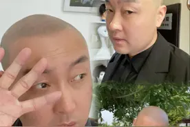 纹发后经常日光浴会影响褪色速度和保持年限吗？图片