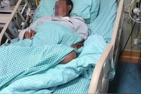 大爷吃野生蘑菇后产生幻觉拿刀割自己，两次血浆置换后脱险图片