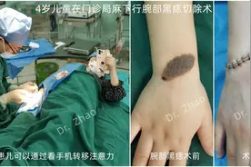 门诊手术的流程及注意事项图片