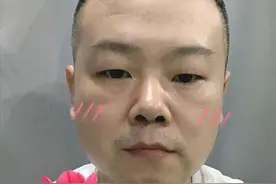 岳云鹏晒减肥近照，自嘲减不了肥还费钱，关键是饥饿后的那顿饺子图片