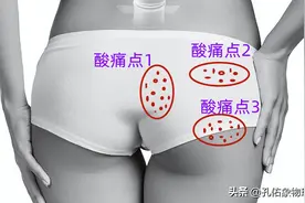 屁股酸痛是咋回事？提醒：这3个位置的疼痛，别忽视了，并非腰突图片