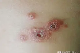 逍遥丸这样用，不仅健脾，还能化瘀散结，祛除痰湿，肝肾同调图片