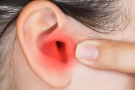 总觉得耳朵痒却又掏不出东西？医生：或提示这3种疾病，别大意！图片