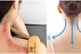 嗓子痛如刀割，刮刮这里，立竿见影！图片
