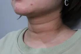 女人脖子出现“三条线”，很多人都不在意，可有了颈纹更显老气图片