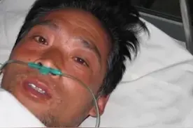 日本工人遭核辐射，被当白鼠强行续命83天，临终前烂成“烤全羊”图片