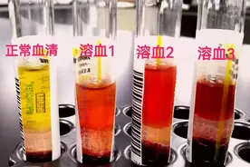 需要重新采血？揭秘检验科关于溶血那些事儿图片