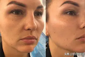 女性40岁后想比别人年轻，要从这几方面下功夫（医生经验总结）图片