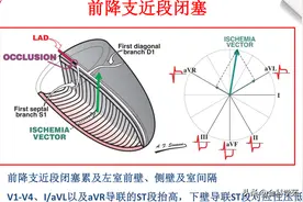 心电图理论笔记5：心脏解剖（心室）图片