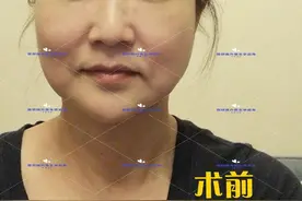 45岁以上的都会出现的衰老特征，听听外科医生的专业建议图片