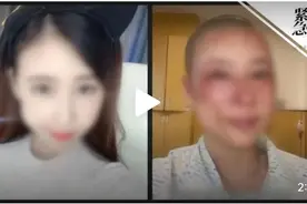 新婚第2天遭家暴，硫酸泼了她一脸，网友：苍蝇不叮无缝的蛋！图片