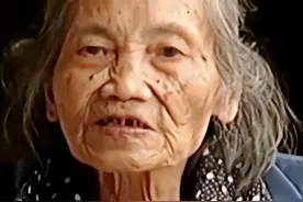 四川90岁高龄产妇，怀胎60年至今未生，检查后发现胎儿还没腐烂图片