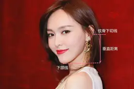 下巴填充，有哪些方法？图片