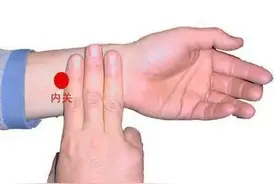 腕管综合征图片
