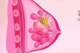 乳腺癌患者：抗癌10年，她的战斗，从体检出的一个微小结节说起图片