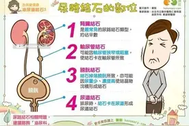 你的尿路结石为什么反复发作呢？图片