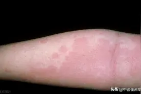 湿气究竟怎么祛？倪海厦告诉你张仲景的治湿思路，横扫一身湿气图片