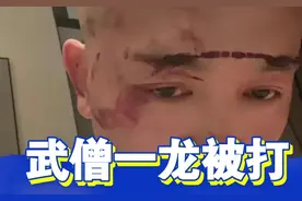 “武僧”一龙自曝被黑衣人打伤后改口不小心撞树上，网友：戏真多图片