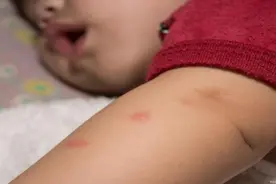 蟑螂对人有什么危害？教你几个小妙招，轻松解决家里蟑螂图片