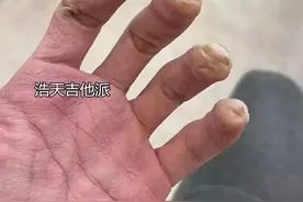 练吉他？比谁的手惨么？图片