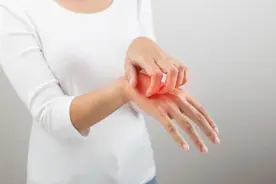 荨麻疹反复发作很多年，真的就没有办法治疗吗？图片