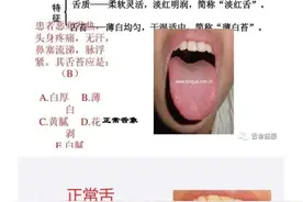 简单直观！中医舌诊图谱来啦图片